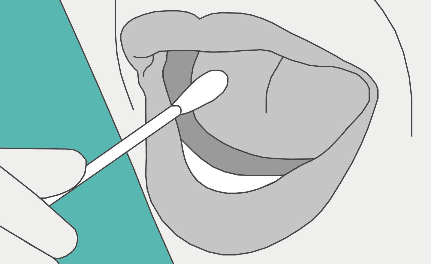 Illustration of the cheek-swab collection process used in home paternity DNA testing kits.
